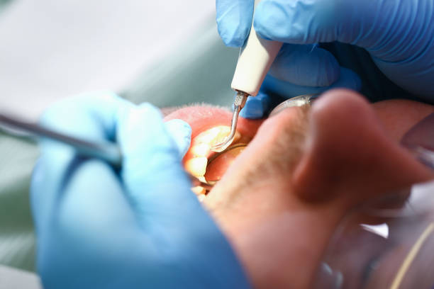 Best Pediatric Emergency Dentist in Dland, MI