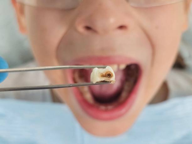Best Emergency Dental Surgery in Dland, MI