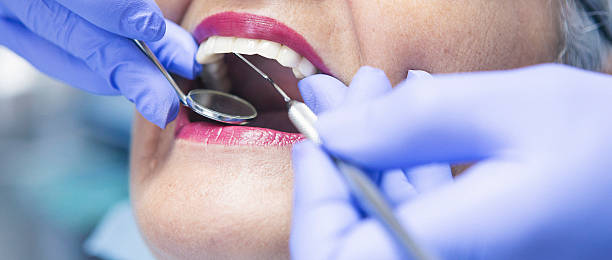 Best Emergency Broken Tooth Repair in Dland, MI